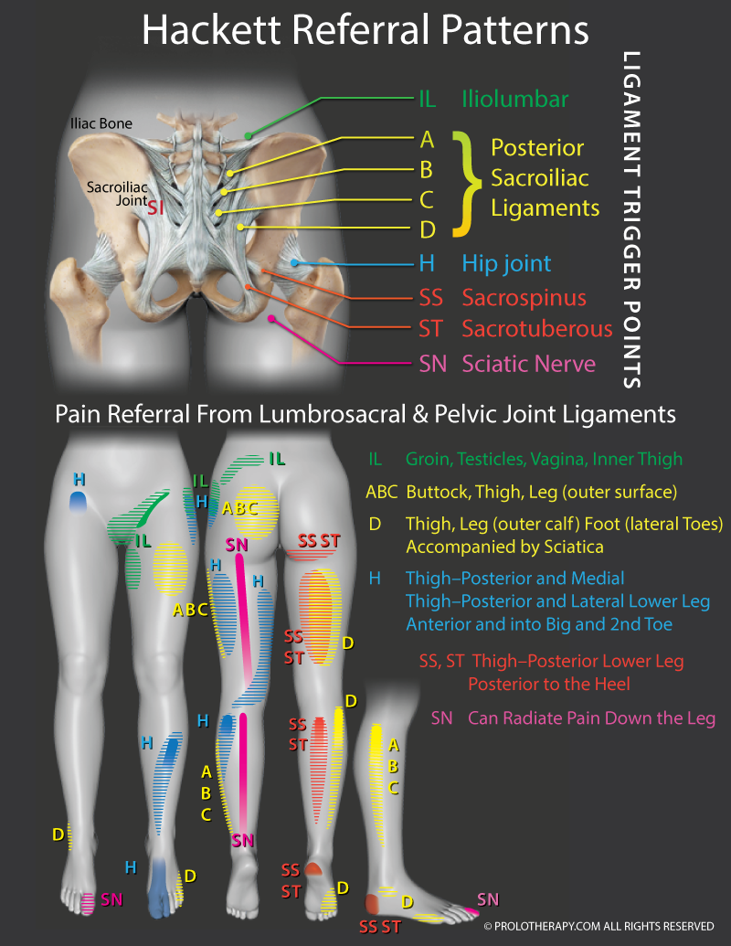 THackett Referral Paterns of the Lumbrosacral and Pelvic Joing Ligaments