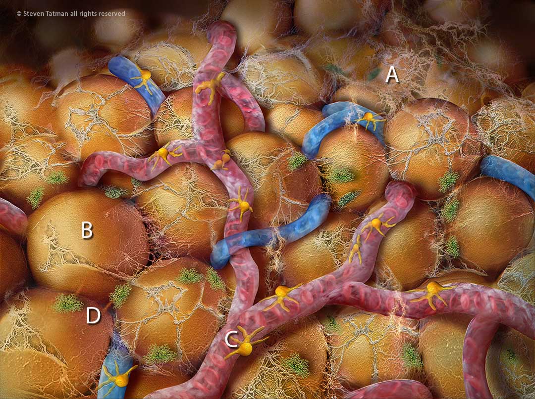 An anatomical view of the pelvic anatomy showing how the pirifomis muscle spasms trigger pain in the sciatic nerve.