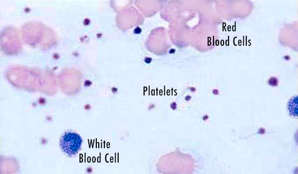 A microscopic slide of whole blood