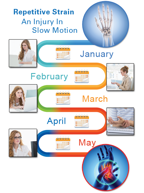 A woman developing carple tunnel syndrom over a period of months.