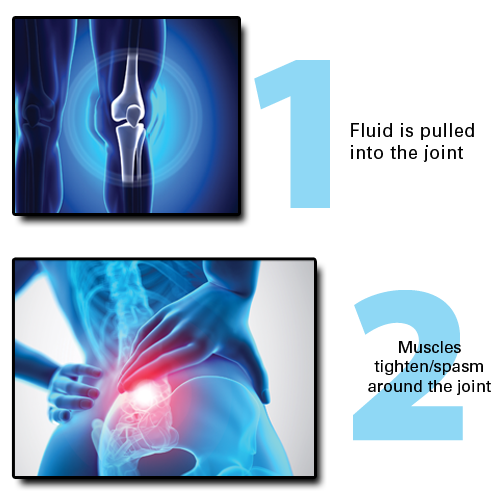 The three stages of joint instability