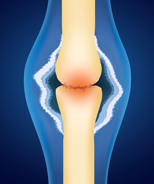 Prolotherapy research topics image showing a doctor using a tablet