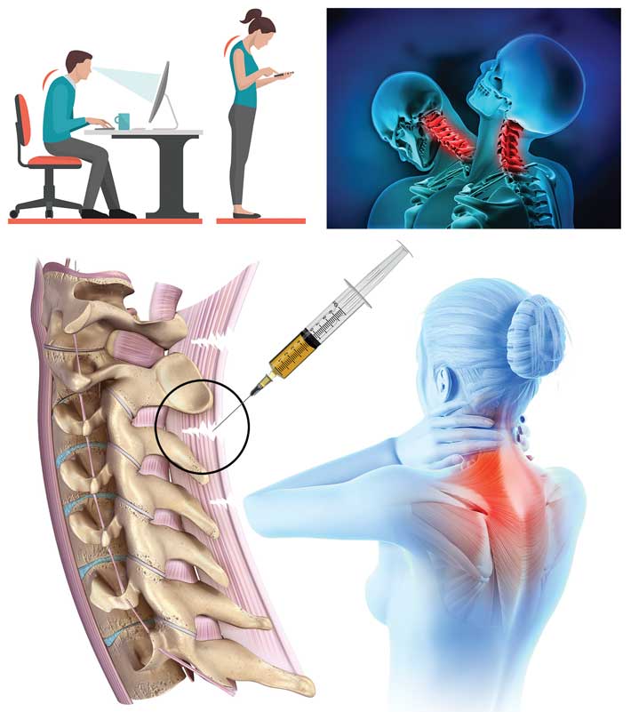 Trauma and/or repetitive injury results in ligament micro-tears, instability, and pain, often treatable with Prolotherapy.