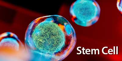 Mesenchymal Stem Cells used in Biocellular Stem Cell-rich Prolotherapy for treating musculoskeletal injuries.